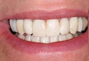 Granite View Dental