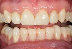 Granite View Dental