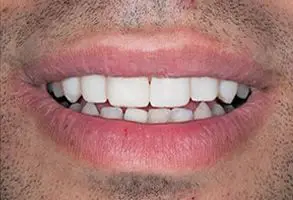 Granite View Dental