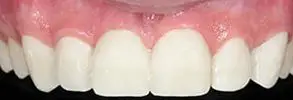 Granite View Dental