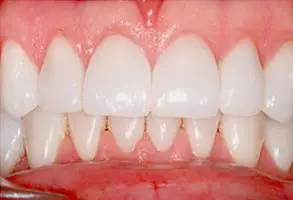 Granite View Dental