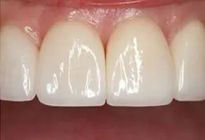 Granite View Dental