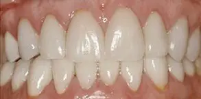 Granite View Dental