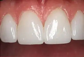 Granite View Dental