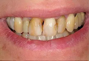 Granite View Dental