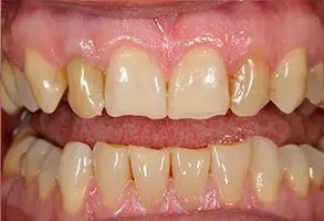 Granite View Dental