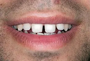 Granite View Dental