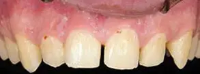 Granite View Dental
