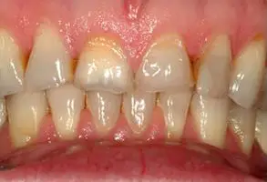 Granite View Dental