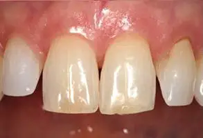 Granite View Dental