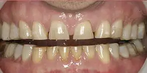 Granite View Dental