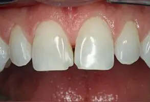 Granite View Dental